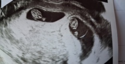 Życie to czasem zaskakuje. Będzie większa chata, czwartego nie wykluczaliśmy, więc luzik. No jednak nie, bo naszym oczom pokazały się bliźniaki :laughing: No tego to nie przewidziałem, będzie impreza na całego. Nie sądziłem, że będziemy aż tak wielodzietni :stuck_out_tongue: